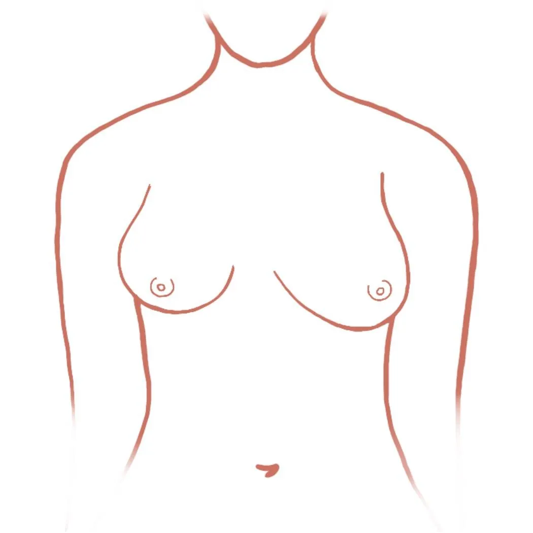 Senos asim&eacute;tricos