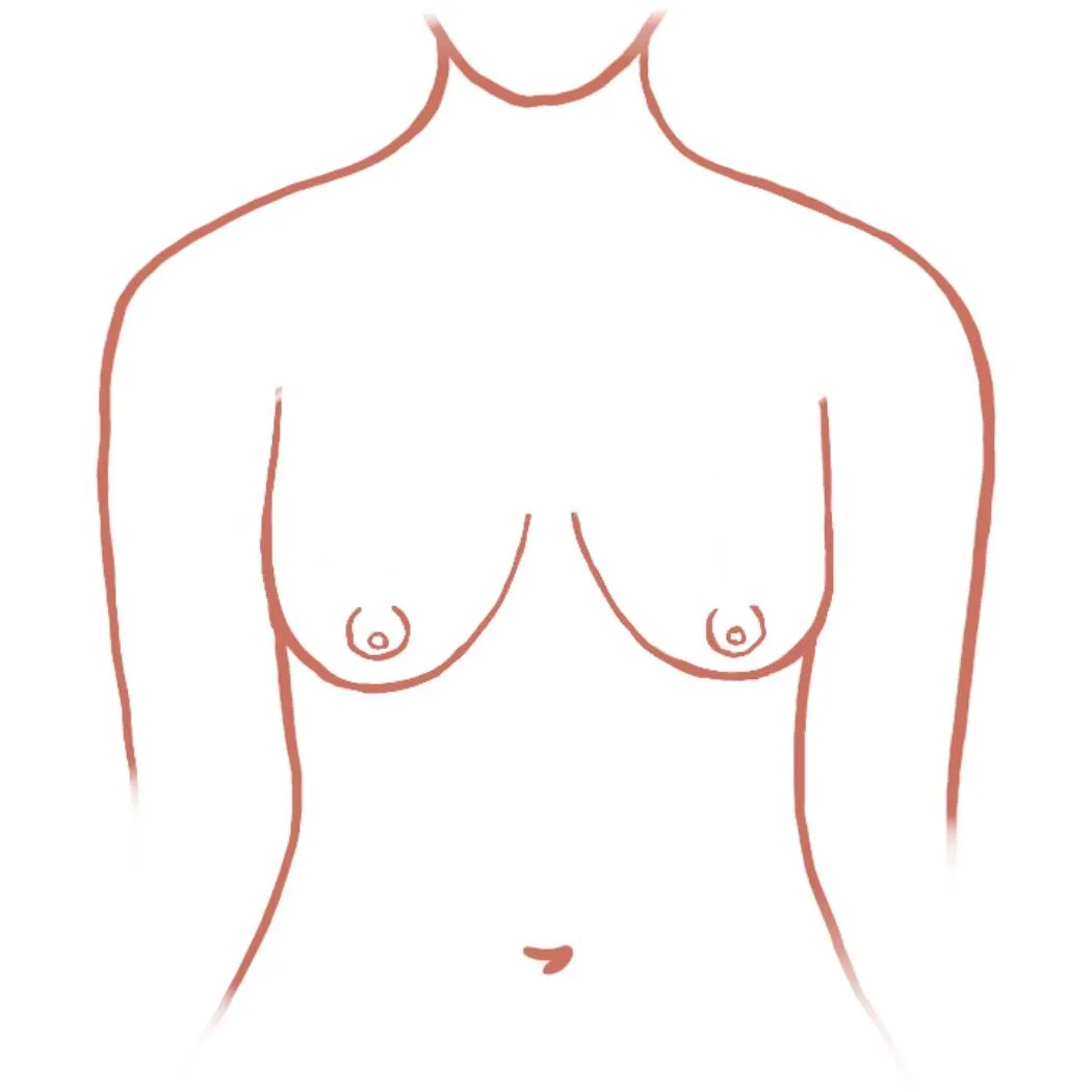 Pechos ca&iacute;dos