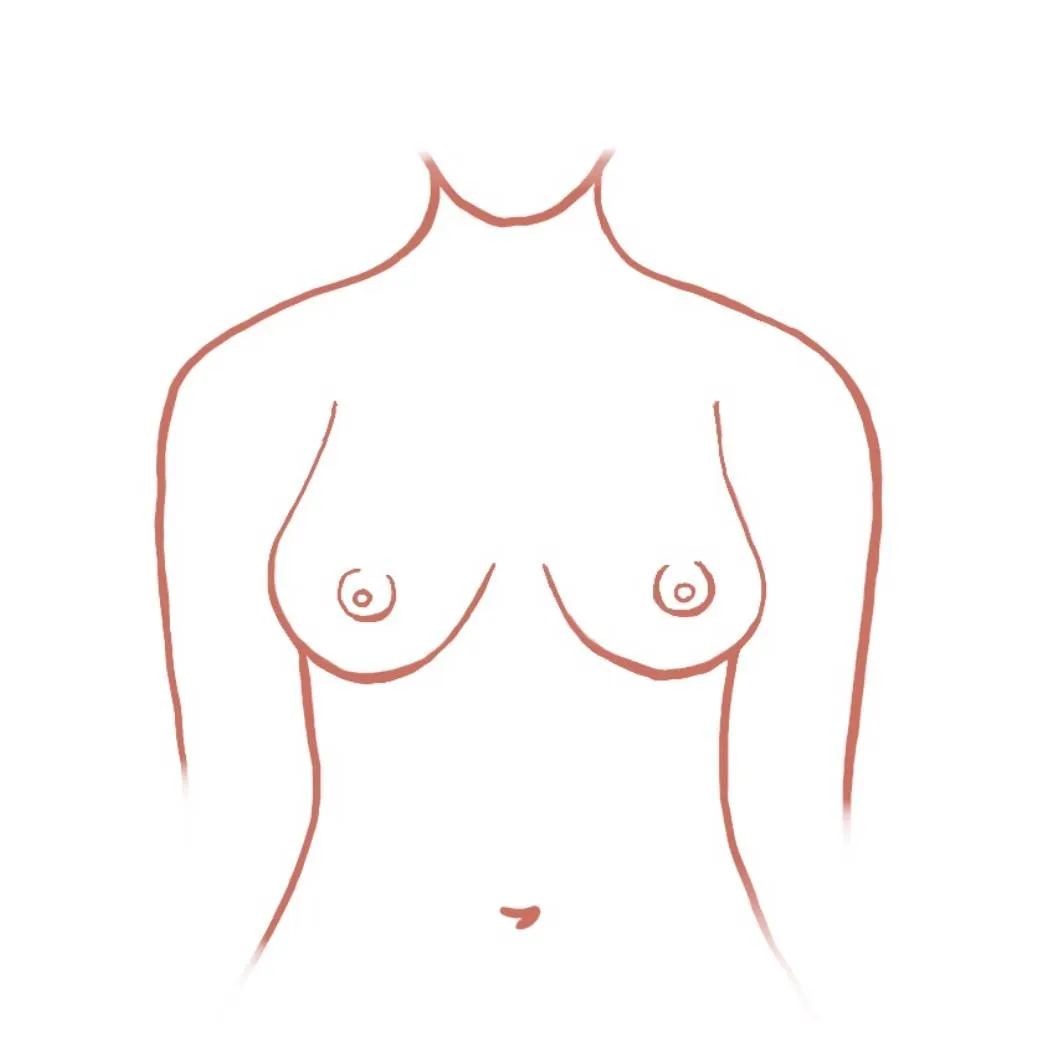 Pechos en forma de l&aacute;grima